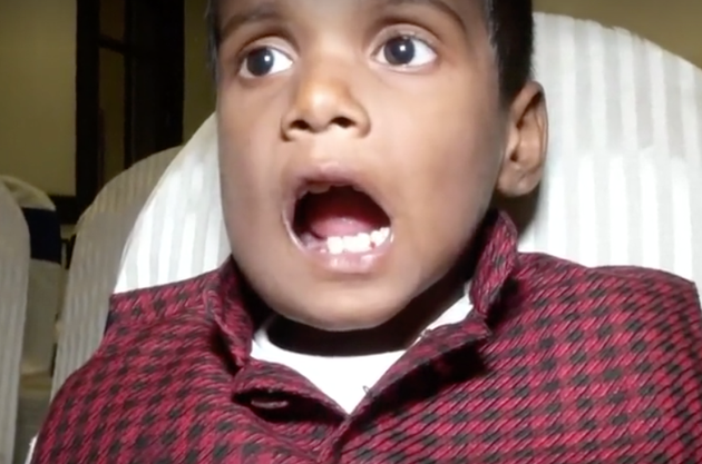 Cluster Of 526 Teeth Removed From Seven-Year-Old Boy’s Mouth