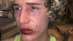 Un joven sufre una agresión homófoba a la salida de una discoteca en