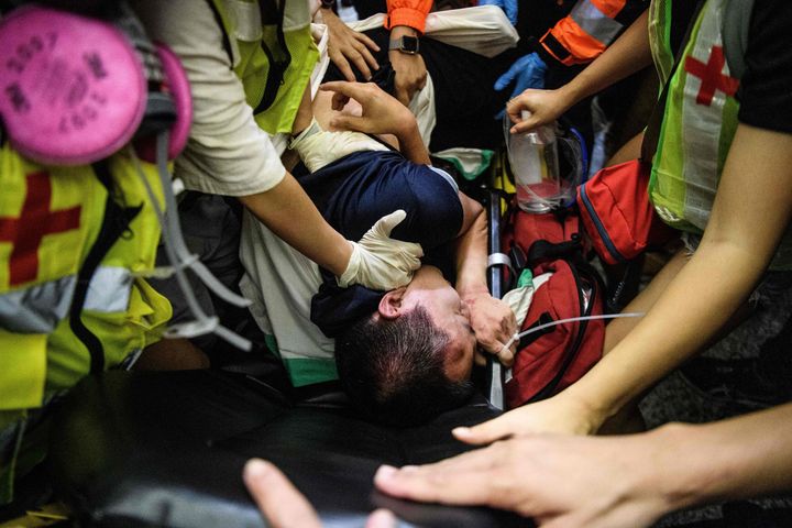  An injured man who was suspected by protestors of being a Chinese spy is taken away by paramedics at Hong Kongs international airport, early on Aug. 14, 2019.