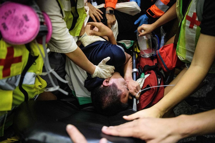  An injured man who was suspected by protestors of being a Chinese spy is taken away by paramedics at Hong Kongs interna