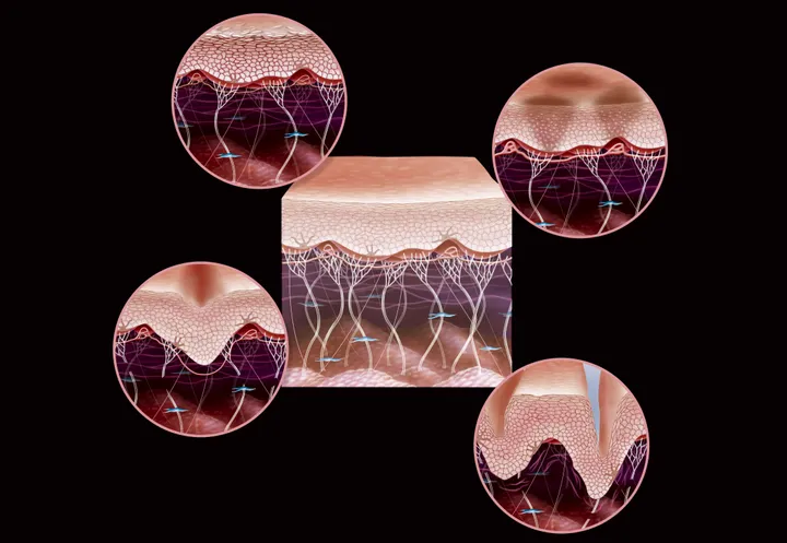 Illustration of the signs of ageing in skin, dulling of the epidermis, brown spots, skin slackening and wrinkles. In the centre of the image: a cross-section illustration of young skin enabling a comparison with different types of ageing: -Top left illustrates the dulling of the epidermis, the skin is dry and cutaneous microrelief is irregular, causing the skin to become permeable to pollutants and dehydration. Superficial microcirculation is less good; skin cells become less oxygenated. -Top right illustrates spots. If they are brown it is due to melanin deposits, when red it is due to superficial microcirculation vessels, which are dilated. -Bottom left illustrates the loss of firmness due to diminished activity of the fibroblasts (blue). Fibroblasts are responsible for skin's elasticity, producing elastin and collagen -Bottom right illustrates wrinkles due to the deterioration of collagen (white vertical) and elastin (pink horizontal) fibers. (Photo by: Jacopin/BSIP/Universal Images Group via Getty Images)