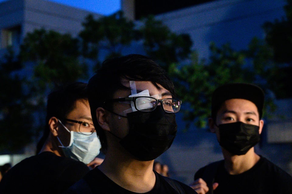 TOPSHOT - A student covers his right eye, after a woman suffered an eye injury which demonstrators blamed...