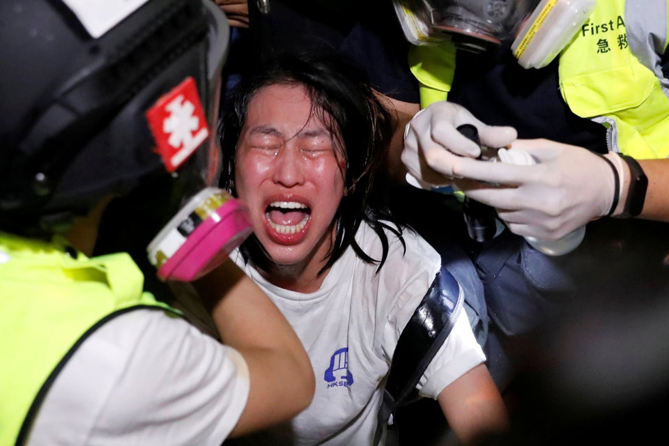 An anti-extradition bill protester receives medical attention after tear gas and pepper spray was used...
