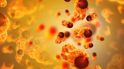 Le cancer devient la première cause de décès dans les pays