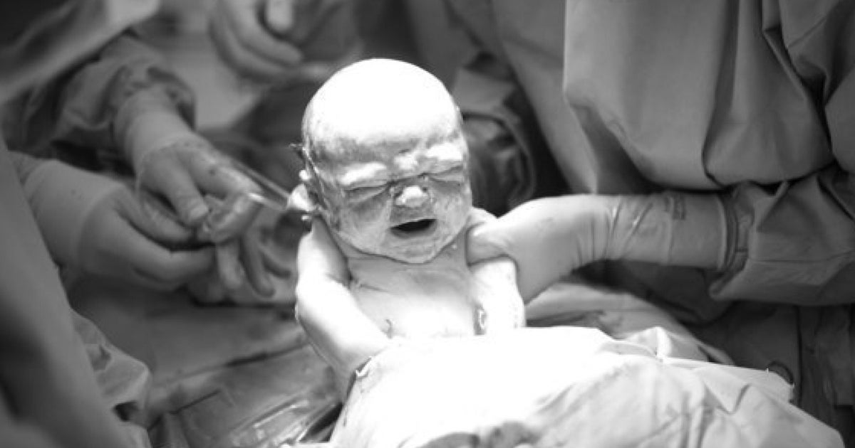 제왕절개가 인류의 진화에 영향을 미칠 수 있다 | 허프포스트코리아