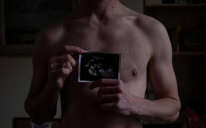 Freddy with his baby scan, photographed by Danny Burrows