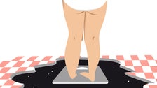 Entonces es tener sobrepeso y tener anorexia. 2 5d768d8a3b00002a74d0c3ac
