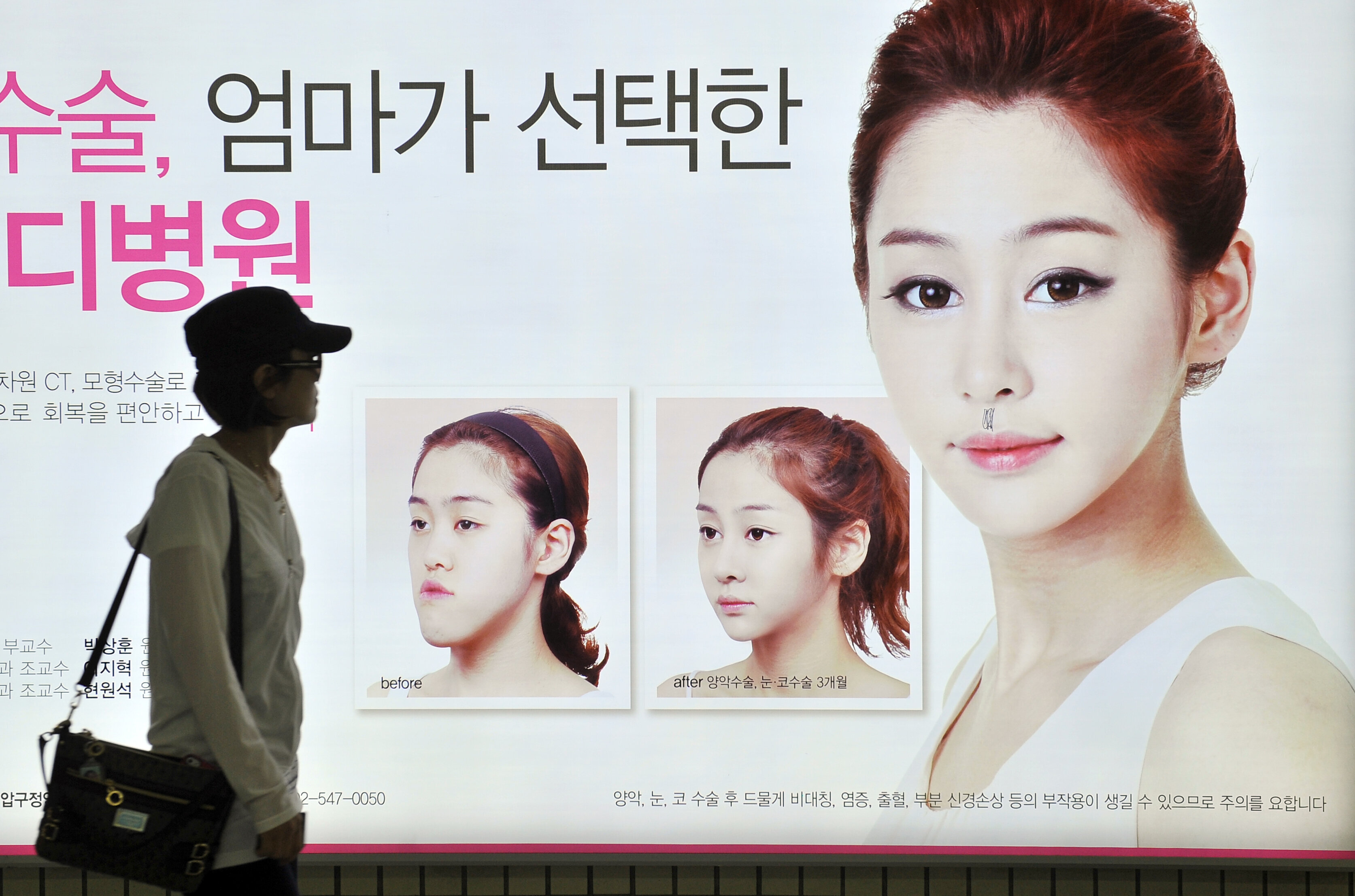 south korean eye surgery