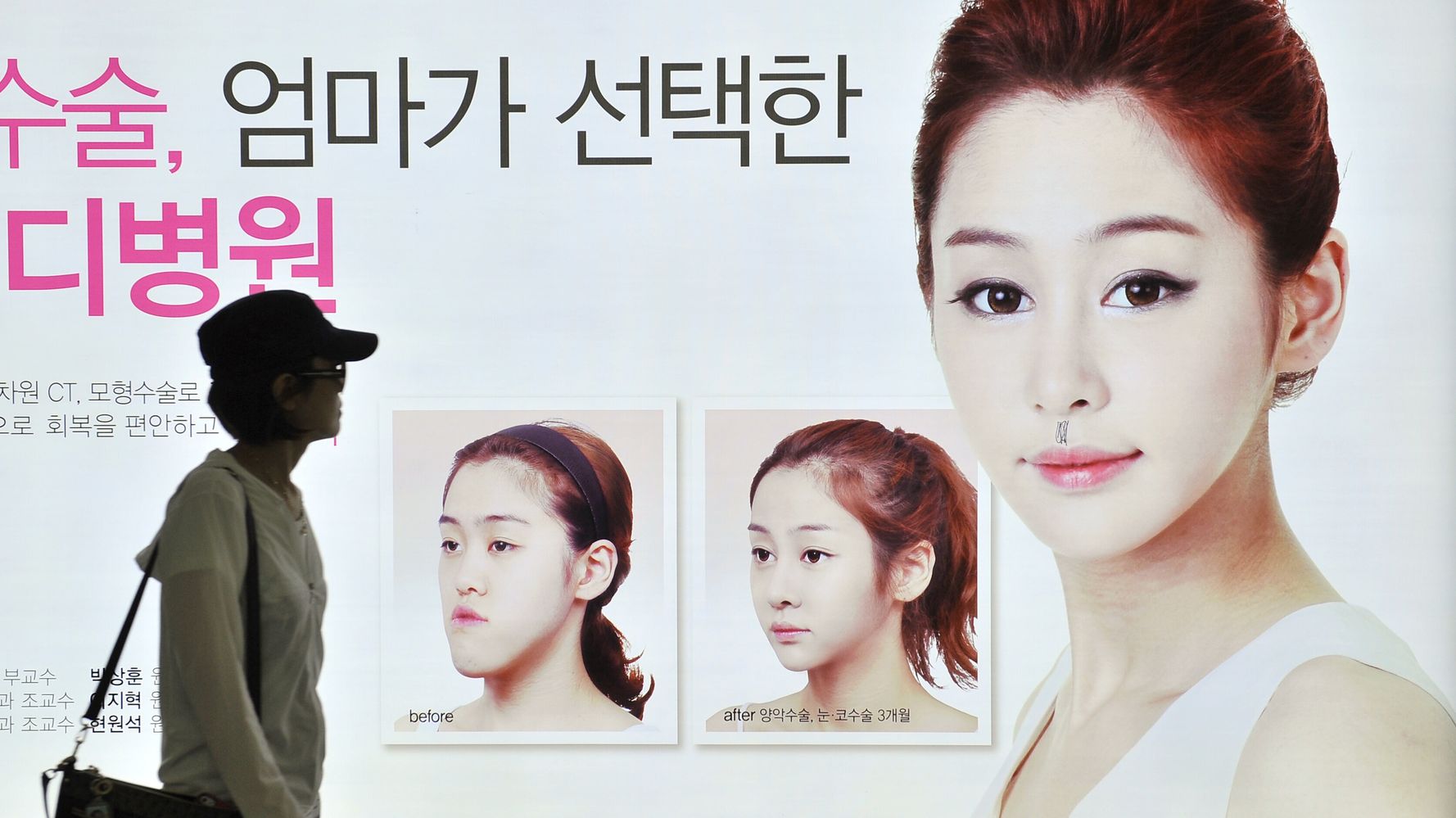 South Korea S Plastic Surgery Boom A Quest To Be Above Normal Huffpost Life