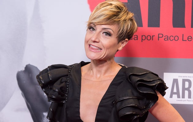 Featured image of post Sara Biyin Pelo Corto En sentido unitario es decir en lo que respecta a cada pelopuede haber de ellos distintos tipos