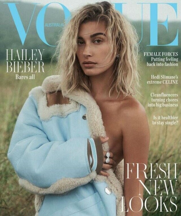 Hailey Baldwin Has A Kendall Jenner Inferiority Complex And, Um,