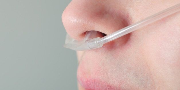 Oxygen tube in the patient's nose