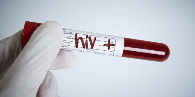 Laboratory Request, Hiv Test, Hiv Positive