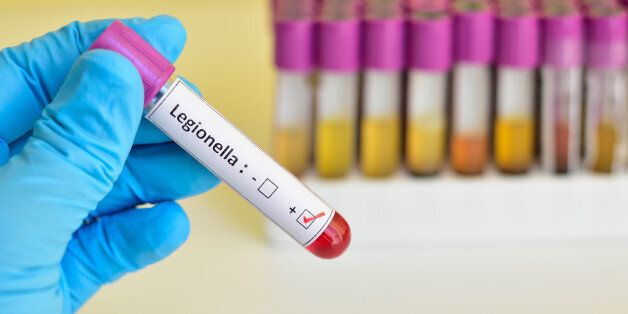 Blood sample positive with Legionella bacteria