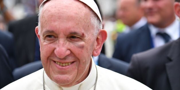 Pope Francis shows a bruise around his left eye and eyebrow caused by an accidental hit against the popemobile's window glass while visiting the old sector of Cartagena, Colombia, on September 10, 2017.Nearly 1.3 million worshippers flocked to a mass by Pope Francis on Saturday in the Colombian city known as the stronghold of the late drug lord Pablo Escobar. / AFP PHOTO / Alberto PIZZOLI (Photo credit should read ALBERTO PIZZOLI/AFP/Getty Images)
