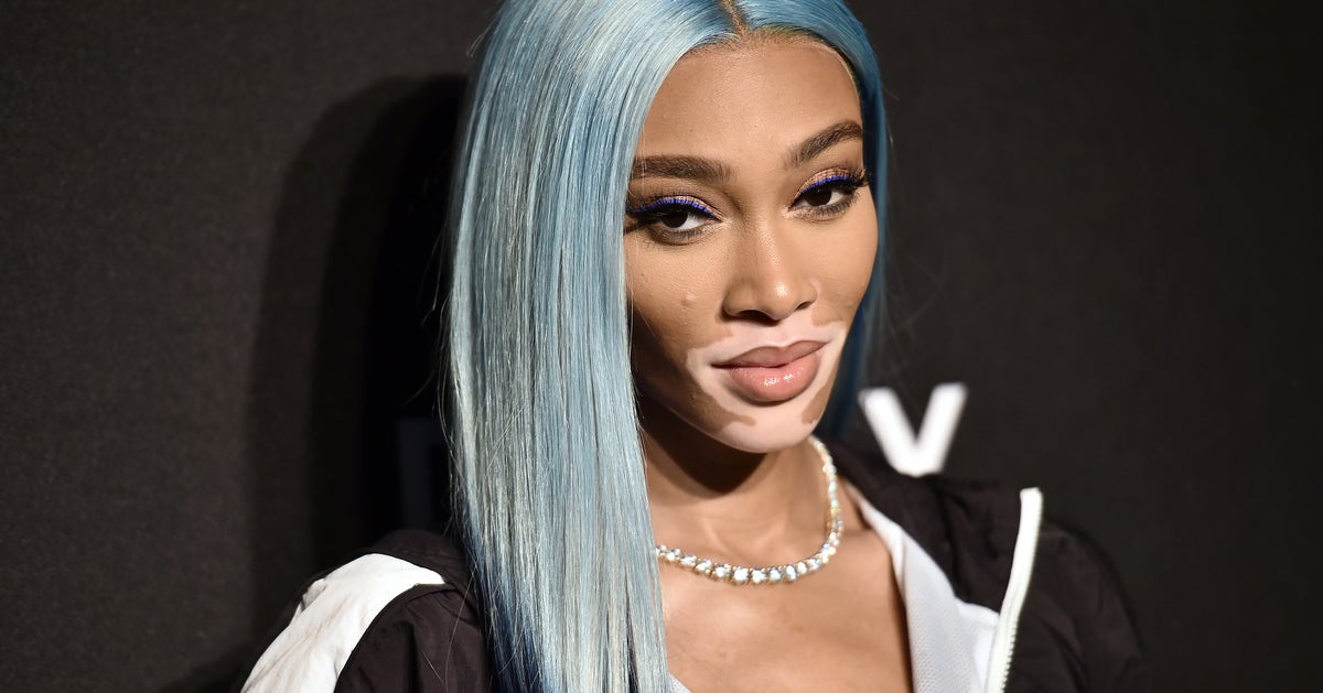 Model Winnie Harlow Faces Backlash After Complaining About Flying In(02)