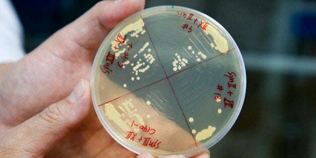 BEIJING, March 10, 2017 -- Dai Junbiao, head of Tsinghua University's research team, shows the yeast in the laboratory of Tsinghua University in Beijing, capital of China, March 9, 2017. Chinese scientists have assembled four synthetic yeast chromosomes, making China the second country capable of designing and building eukaryotic genomes. The findings were published in Friday's edition of journal Science, marking a step closer to building synthetic life. In the study, researchers with Tianjin University, Tsinghua University and BGI-Shenzhen construct the synthetic active chromosomes through exactly matching the synthetic genome with the designed sequence for the first time. (Xinhua/Shen Bohan via Getty Images)