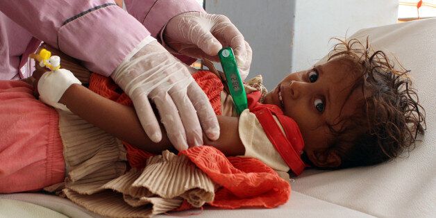 TOPSHOT - A Yemeni child suspected of being infected with cholera is checked by a doctor at a makeshift hospital operated by Doctors Without Borders (MSF) in the northern district of Abs in Yemen's Hajjah province , on July 16, 2017.The country has also been hit by a cholera outbreak that has killed more than 1,600 people and left some 270,000 infected. / AFP PHOTO / STRINGER (Photo credit should read STRINGER/AFP/Getty Images)