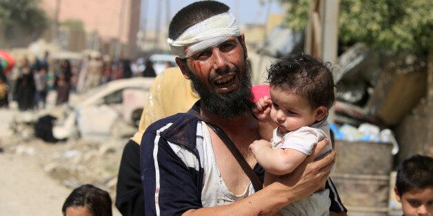 ATTENTION EDITORS - VISUAL COVERAGE OF SCENES OF INJURY OR DEATH A wounded displaced Iraqi man who fled from clashes, carries his child in western Mosul, Iraq, June 3, 2017. REUTERS/Alaa Al-Marjani TPX IMAGES OF THE DAY