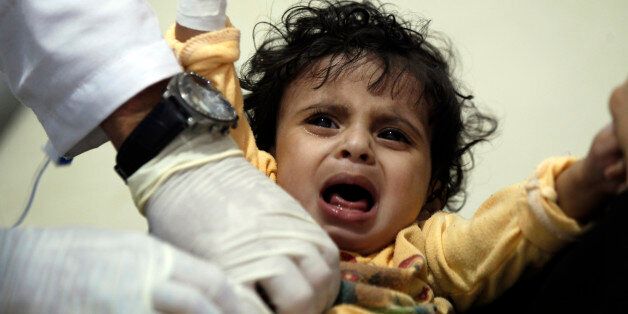 A Yemeni child, suspected of being infected with cholera, receives treatment at a hospital in Sanaa on May 15, 2017. / AFP PHOTO / Mohammed HUWAIS (Photo credit should read MOHAMMED HUWAIS/AFP/Getty Images)