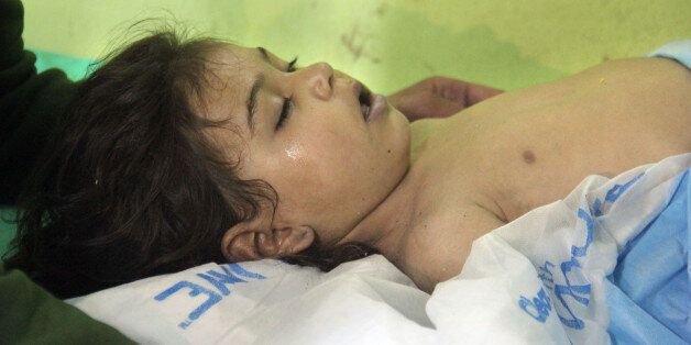 An unconscious Syrian child receives treatment at a hospital in Khan Sheikhun, a rebel-held town in the northwestern Syrian Idlib province, following a suspected toxic gas attack on April 4, 2017.A suspected chemical attack killed at least 58 civilians including several children in rebel-held northwestern Syria, a monitor said, with the opposition accusing the government and demanding a UN investigation. / AFP PHOTO / Omar haj kadour (Photo credit should read OMAR HAJ KADOUR/AFP/Getty Ima