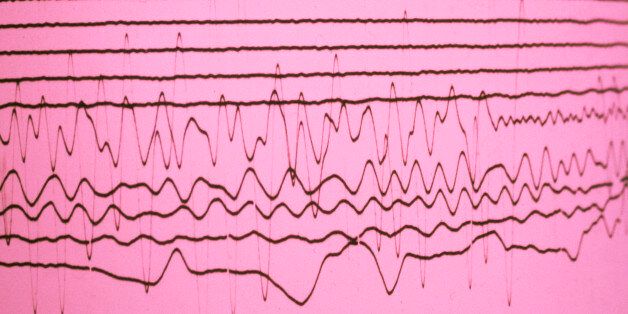 The lines that characterize the danger scale of an earthquake on pink background.