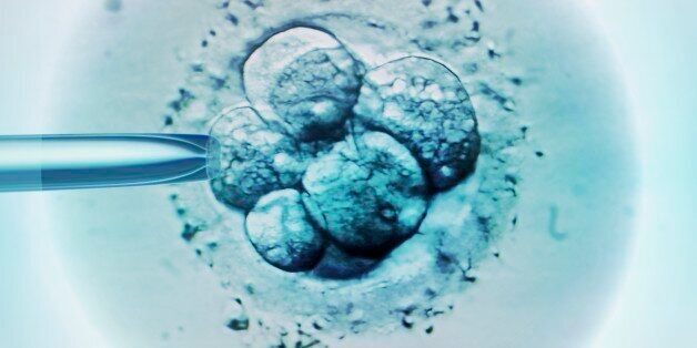 Embryo selection for IVF, light micrograph.