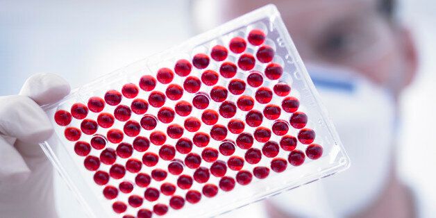 Scientist holding specimen tray