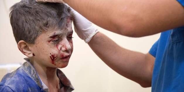 A Syrian boy receives treatment at a make-shift hospital following air strikes on rebel-held eastern areas of Aleppo on September 24, 2016.Heavy Syrian and Russian air strikes on rebel-held eastern areas of Aleppo city killed at least 25 civilians on Saturday, the Britain-based Syrian Observatory for Human Rights said, overwhelming doctors and rescue workers. / AFP / KARAM AL-MASRI (Photo credit should read KARAM AL-MASRI/AFP/Getty Images)