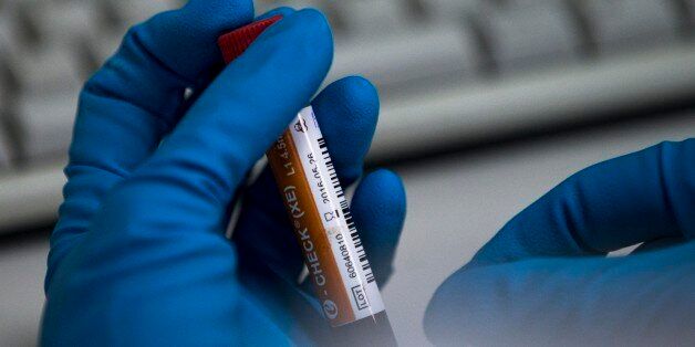 An employee of the Russia's national drug-testing laboratory holds a vial in Moscow, Russia, Tuesday, May 24, 2016. The Russians have been accused of state-sponsored doping at the 2014 Sochi Olympics, and the IOC has asked WADA to carry out a full-fledged investigation and plans to retest Sochi samples. (AP Photo/Alexander Zemlianichenko)