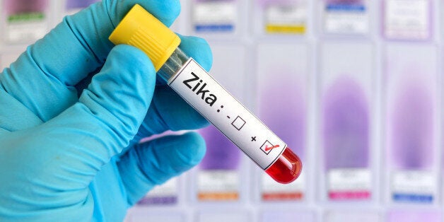 Blood sample positive with Zika virus