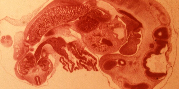 Pig embryo