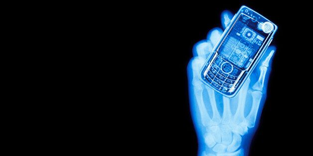 X-ray of man holding mobile phone, close-up