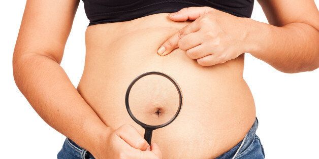 Women fat belly show stretch marks
