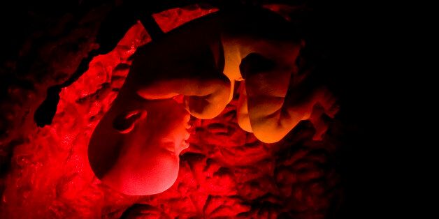 ** FILE ** A human embryo is shown in a three-dimensional film on human reproduction at the Corpus museum in Oegstgeest 35 kilometers (21 miles) southeast of Amsterdam, Netherlands in this March 14, 2008 file photo.
