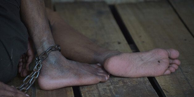 This picture taken in Brebes on March 16, 2016 shows legs of an Indonesian mentally ill man while resting as all patients are shackled to their wooden beds at the Bina Lestari Mandiri healing center in Brebes. Human Rights Watch -- who interviewed around 150 people for their report, from the mentally ill to health professionals -- said there are currently almost 19,000 people in Indonesia who are either shackled or locked up in a confined space, a practice known locally as 'pasung'. Chaining up the mentally ill has been illegal in Indonesia for nearly 40 years but remains rife across the country, especially in rural areas where health services are limited and belief in evil spirits prevail, according to HRW. / AFP / ADEK BERRY / TO GO WITH AFP STORY INDONESIA HEALTH RIGHTS,FOCUS BY NICK PERRY (Photo credit should read ADEK BERRY/AFP/Getty Images)