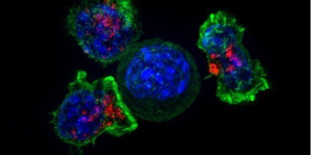 Killer T cells (green and red) surround a cancer cell (blue, center). Killer T cells are immune cells that target and remove unhealthy cells, including cancer cells and virus-infected cells. Credit: NICHD/J. Lippincott-Schwartz