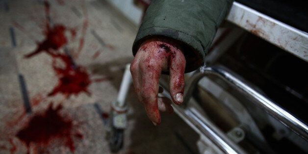 EDITORS NOTE: Graphic content / The body of a Syrian man lies on a stretcher at a make-shift hospital following airstrikes on the rebel-held town of Douma, on the eastern edges of the Syrian capital Damascus on January 16, 2016. / AFP / Abd Doumany (Photo credit should read ABD DOUMANY/AFP/Getty Images)