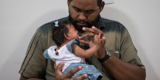Laurinaldo Alves adjusts the pacifier of his daughter Luana Vitoria, who suffers from microcephaly, during a physical stimulation session at the Altino Ventura foundation, a treatment center that provides free health care, in Recife, Pernambuco state, Brazil, Thursday, Feb. 4, 2016. Brazil is in the midst of a Zika outbreak and authorities say they have also detected a spike in cases of microcephaly in newborn children, but the link between Zika and microcephaly is as yet unproven. (AP Photo/Felipe Dana)