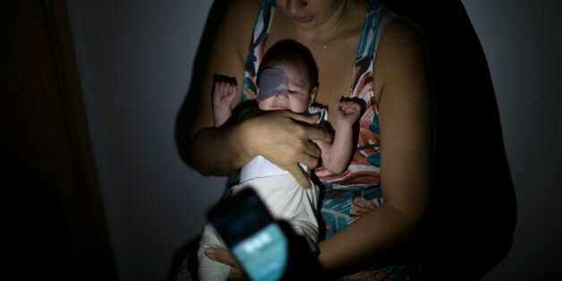 A doctor uses a cellphone flashlight to exam the eye of Pedro Henrique, who was born with microcephaly, at the Altino Ventura foundation in Recife, Brazil, Thursday, Jan. 28, 2016. Brazilian officials still say they believe there's a sharp increase in cases of microcephaly and strongly suspect the Zika virus, which first appeared in the country last year, is to blame. The concern is strong enough that the U.S. Centers for Disease Control and Prevention this month warned pregnant women to reconsider visits to areas where Zika is present. (AP Photo/Felipe Dana)