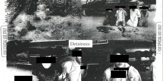This image provided by the Department of Defense shows one of the 198 photos of detainees in Iraq and Afghanistan, involving 56 cases of alleged abuse by U.S. forces, that were released Friday, Feb. 5, 2016, in response to a Freedom of Information request from the American Civil Liberties Union. The often dark, blurry and grainy pictures are mainly of detainees' arms and legs, with faces redacted by the military, revealing bruises and cuts, and they appear far less dramatic than those released more than a decade ago during allegations of torture at Iraq's Abu Ghraib prison. (Department of Defense via AP)