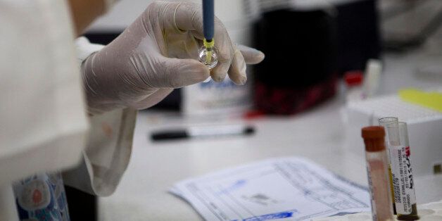 A blood samples from pregnant women are analyzed for the presence of the Zika virus, at Guatemalan Social Security maternity hospital in Guatemala City, Tuesday, Feb. 2, 2016. According to Guatemalan health authorities, the country does not have any confirmed case of pregnant women infected by Zika virus. The virus is suspected to cause microcephaly in newborn children. There is no treatment or vaccine for the mosquito-borne virus, which is in the same family of viruses as dengue. (AP Photo/Mois