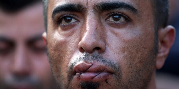 A man claiming to be from Iran, with his mouth sewn shut, takes part in a demonstration with fellow migrants and refugees as they wait to cross the Greek-Macedonian border near Idomeni on November 24, 2015. At least five migrants stuck on the Greek-Macedonian border on Monday sewed their lips in protest at not being allowed to continue their journey to Europe. Syrian, Iraqi and Afghan refugees are allowed through but those deemed economic migrants -- mainly people from Iran, Pakistan and Bangladesh -- are blocked. AFP PHOTO /Sakis Mitrolidis / AFP / SAKIS MITROLIDIS (Photo credit should read SAKIS MITROLIDIS/AFP/Getty Images)