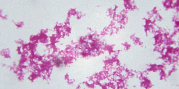 Microscopic Image of Yersinia Pestis