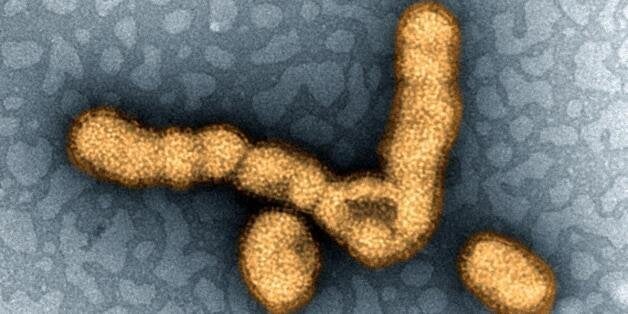 Colorized transmission electron micrograph showing H1N1 influenza virus particles. Credit: NIAID