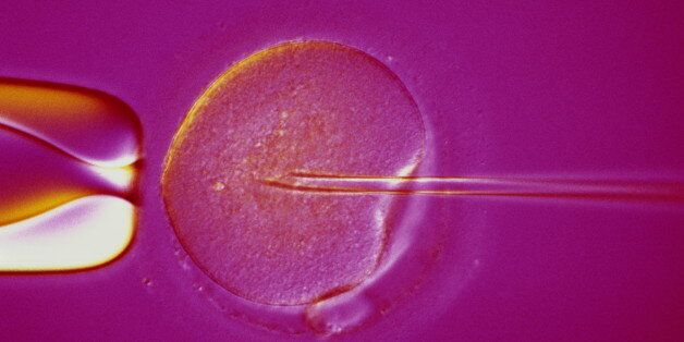 Light micrograph. Intracytoplasmic Sperm Injection (ICSI) is an artifical fertilzation technique. A single sperm is injected into the cytoplasm of an egg, via a microneedle. This technique is used in treatment of severe male infertility.