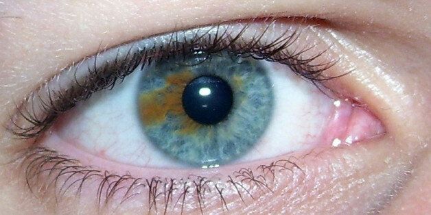 A blue eye with a brown section