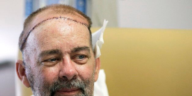 In this photo taken on Wednesday, June 3, 2015, James Boysen is interviewed in his hospital bed at Houston Methodist Hospital in Houston. Texas doctors say he received the world's first skull and scalp transplant from a human donor to help heal a large head wound from cancer treatment. (AP Photo/Pat Sullivan)