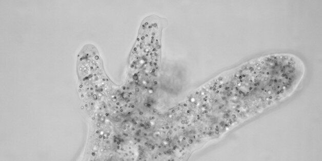 A live Amoeba seen at 400x magnification. Amoeba move by extending pseudopods from their cells; two are clearly visible in this picture (the amoeba is crawling towards the upper-right). Also visible are hundreds of vesicles inside the cell.