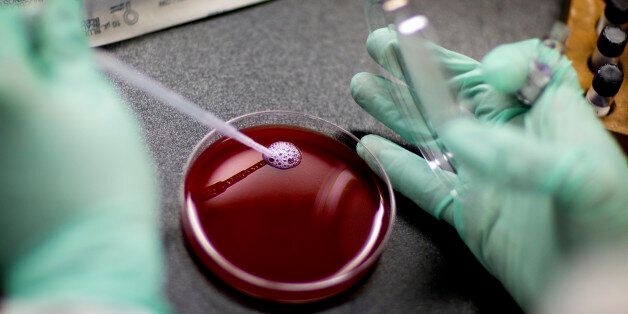 Microbiologist Johannetsy Avillan adds samples of a bacterium to a blood plate in an anaerobe lab within the Infectious Disease Laboratory at the federal Centers for Disease Control and Prevention, Monday, Nov. 25, 2013, in Atlanta. (AP Photo/David Goldman)